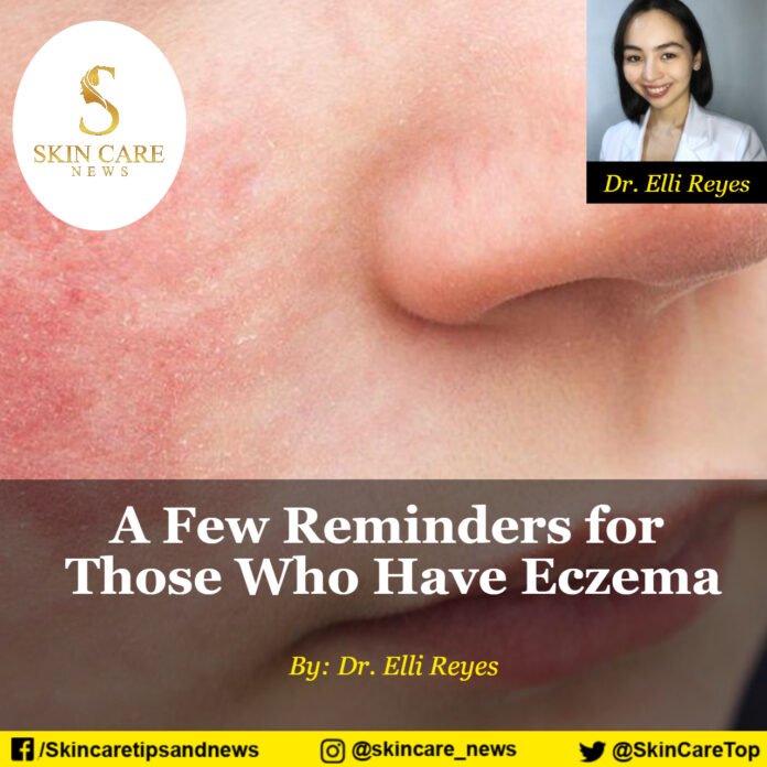 A Few Reminders for Those Who Have Eczema