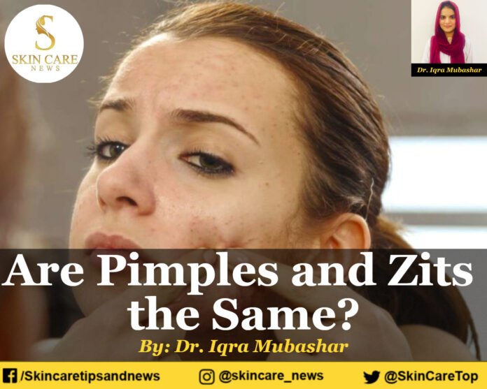 Are Pimples and Zits the Same?
