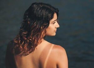 Why Does Our Skin Get Tanned After Sun Exposure?