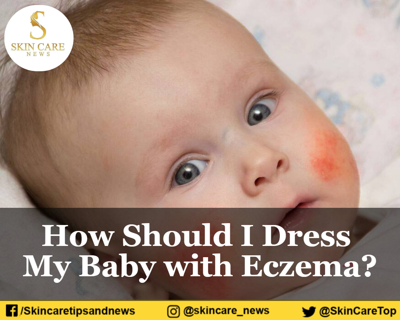 How Should I Dress My Baby with Eczema?