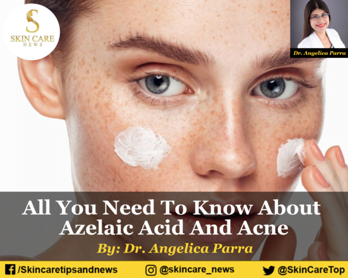 All You Need To Know About Azelaic Acid And Acne
