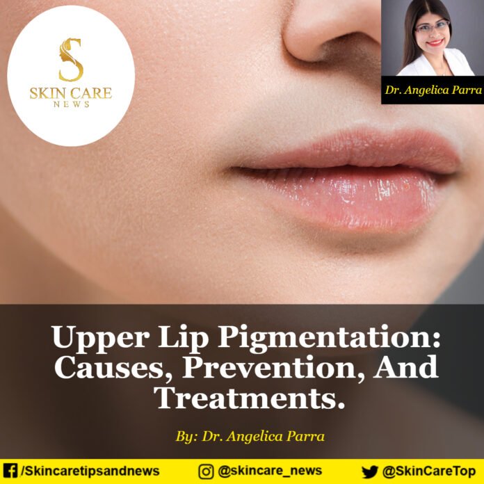 Upper Lip Pigmentation: Causes, Prevention, And Treatments.