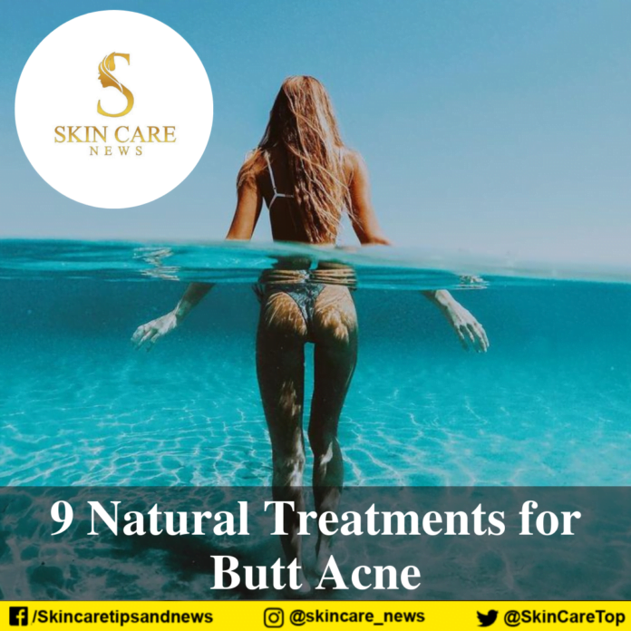 9 Natural Treatments for Butt Acne