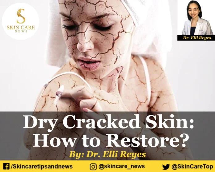 Dry Cracked Skin: How to Restore?