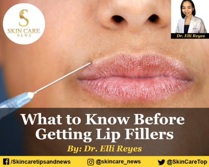 What to Know Before Getting Lip Fillers