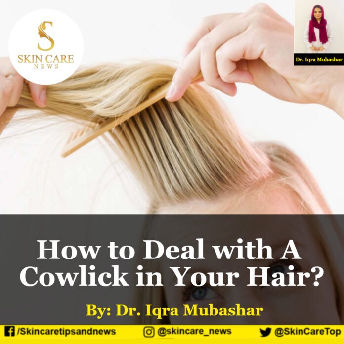 How to Deal with A Cowlick in Your Hair?