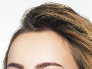 How to Deal with A Cowlick in Your Hair?
