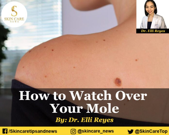 How to Watch Over Your Moles