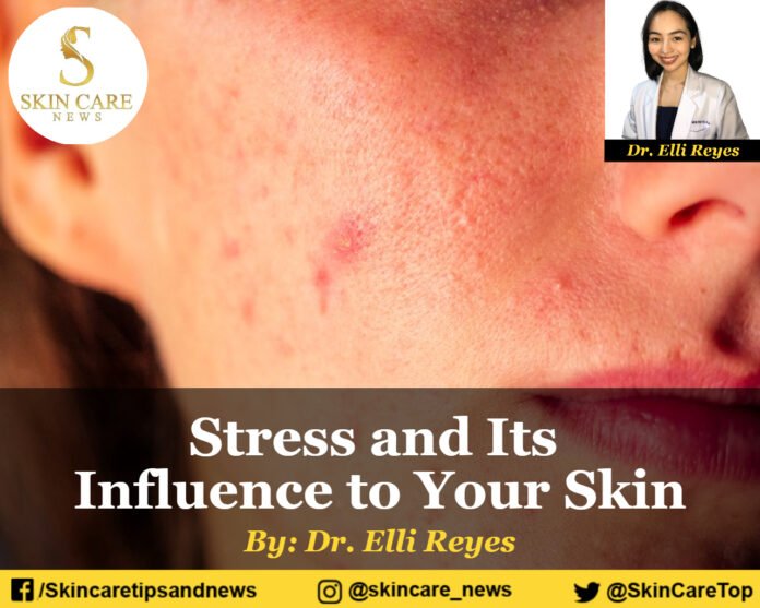 Stress and Its Influence to Your Skin