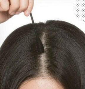 How to Care for Your Scalp in Winters?