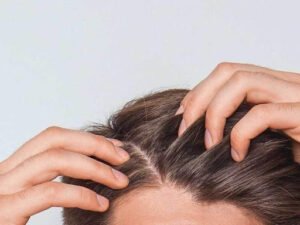 How to Care for Your Scalp in Winters?