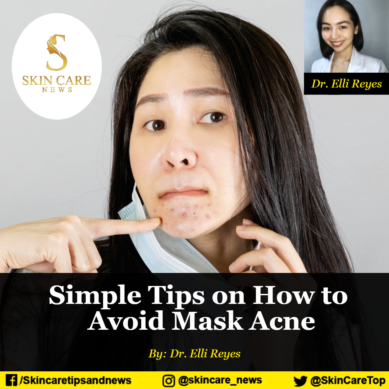 Simple Tips on How to Avoid Mask Acne