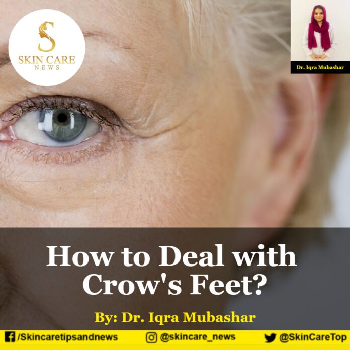 How to Deal with Crow's Feet?