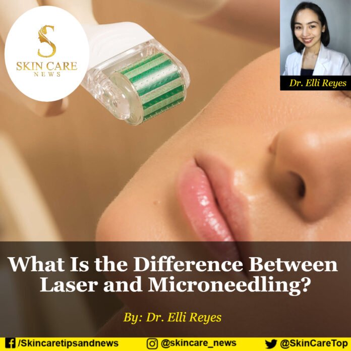 What Is the Difference Between Laser and Microneedling?