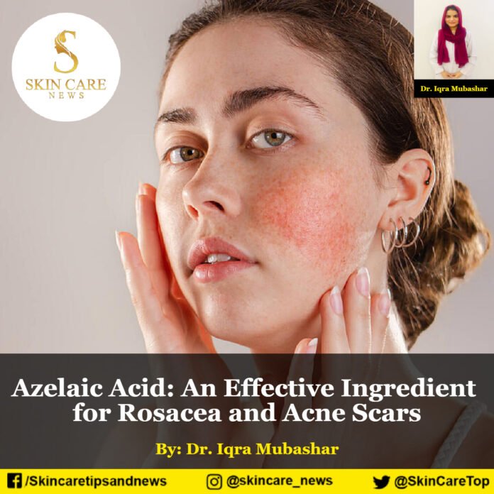 Azelaic Acid: An Effective Ingredient for Rosacea and Acne Scars