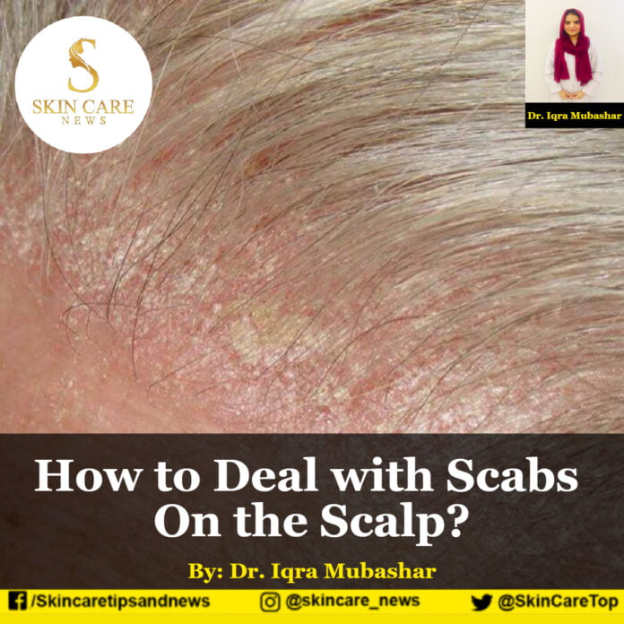 How to Deal with Scabs On the Scalp?