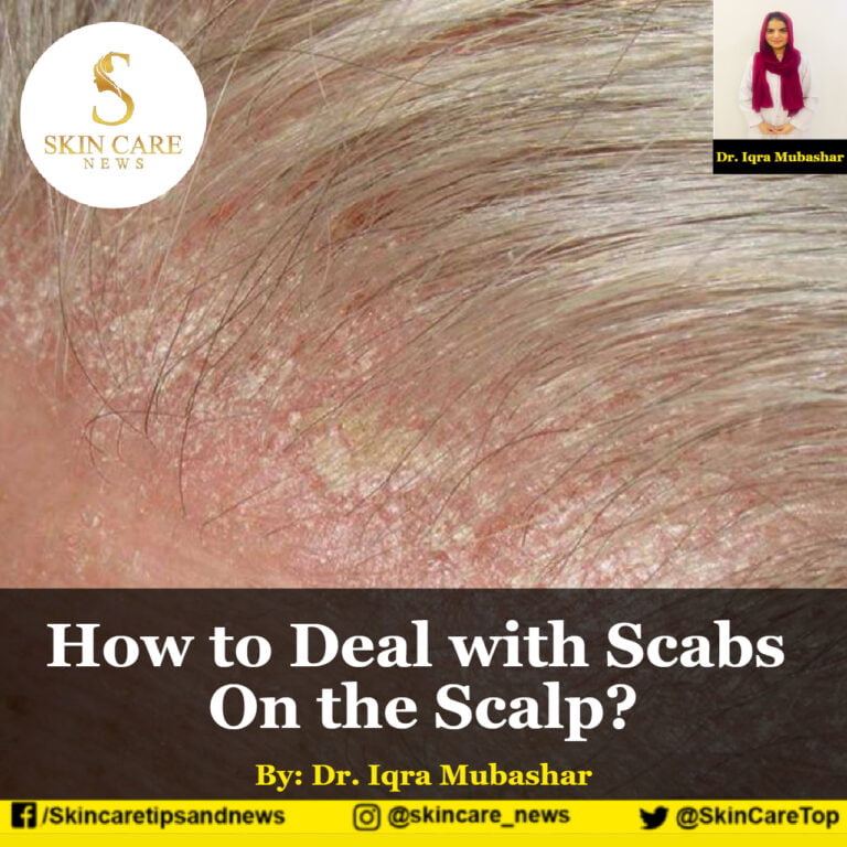 How To Deal With Scabs On The Scalp?