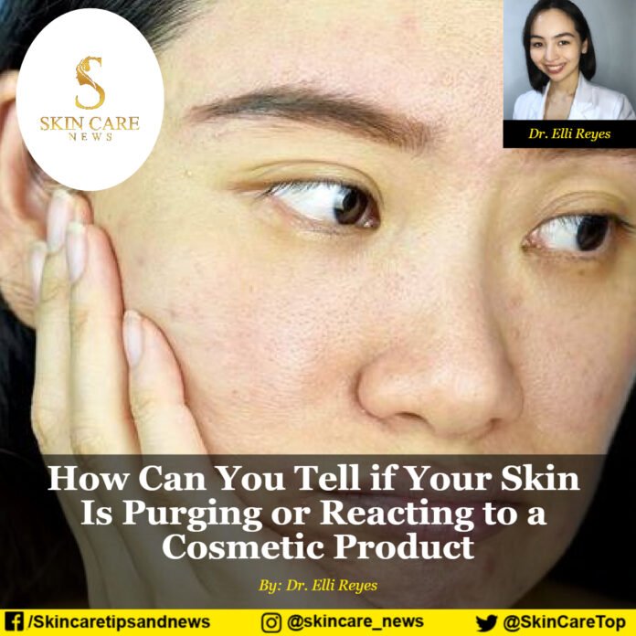 How Can You Tell if Your Skin Is Purging or Reacting to a Cosmetic Product