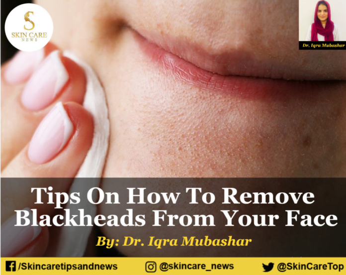 Tips On How To Remove Blackheads From Your Face