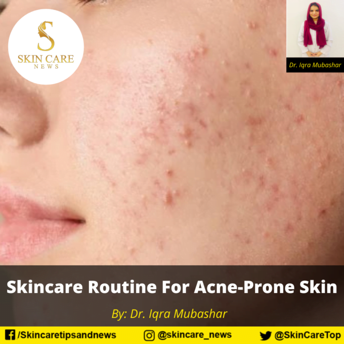 Skincare Routine For Acne-Prone Skin