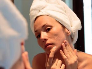 Can You Fade Your Burn Scars?