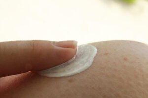 Benzoic Acid: A Treatment For Acne