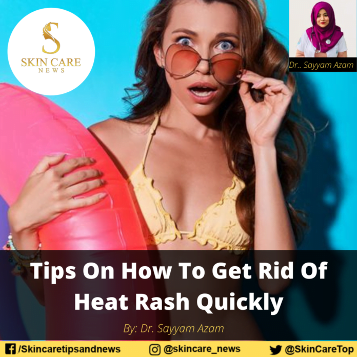 Tips On How To Get Rid Of Heat Rash Quickly