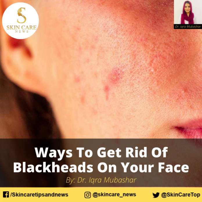 Ways To Get Rid Of Blackheads On Your Face