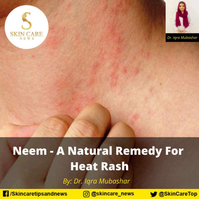 Neem A Natural Remedy For Heat Rash