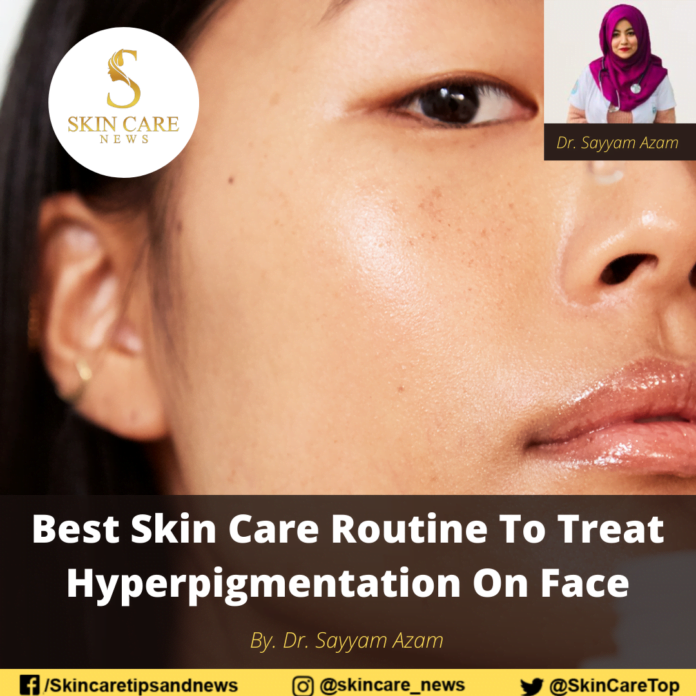 Best Skin Care Routine To Treat Hyperpigmentation On Face