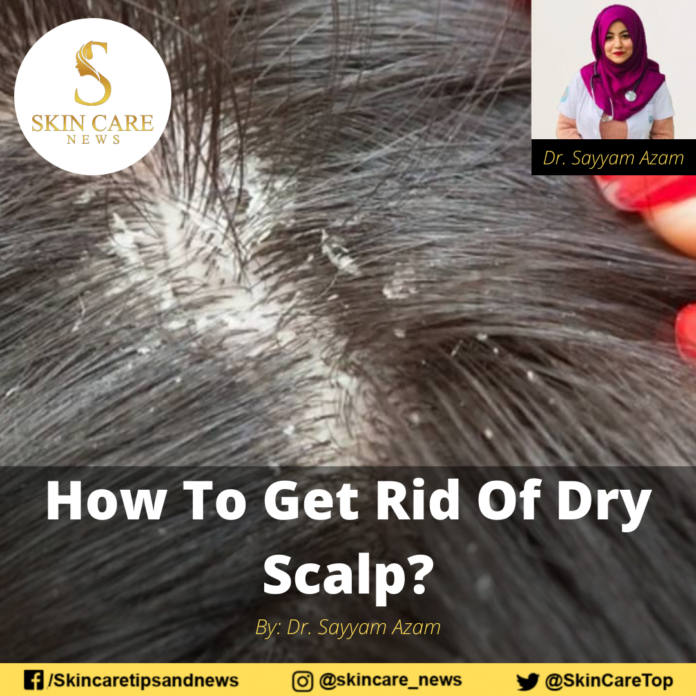 How To Get Rid Of Dry Scalp?