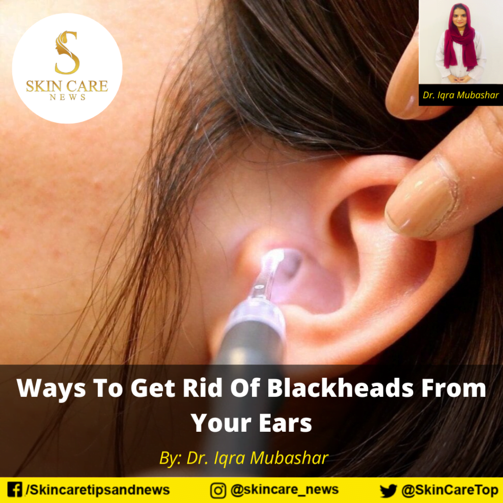 Ways To Get Rid Of Blackheads From Your Ears