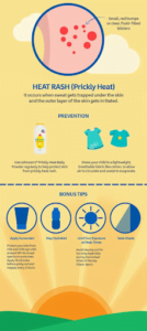 All You Need To Know About Heat Rash