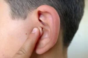 Kulaklarınızdaki Siyah Noktalardan Kurtulmanın Yolları