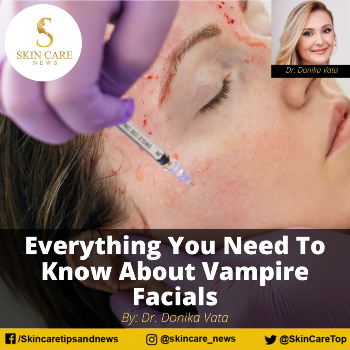 Everything You Need To Know About Vampire Facials