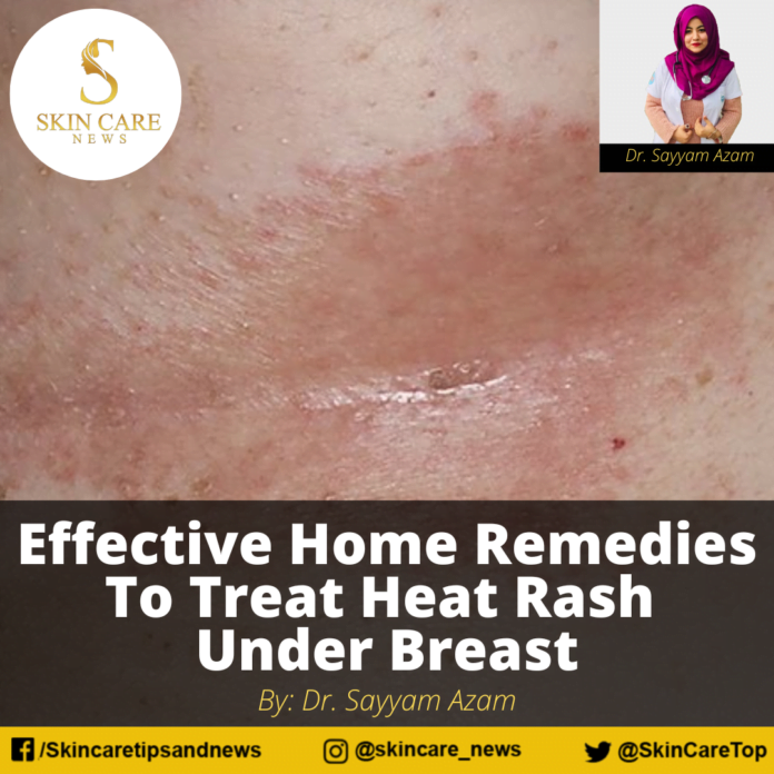 home-remedies-to-treat-the-rashes-under-the-breasts-youtube