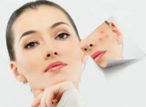 Niacinamide - Cilt İçin Harika Bir Bileşen