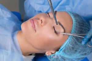 Eyelid Surgery – The Most Common Cosmetic Procedure.......