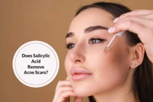 Salicylic Acid – An Effective Cleanser To Eliminate Acne And Scars
