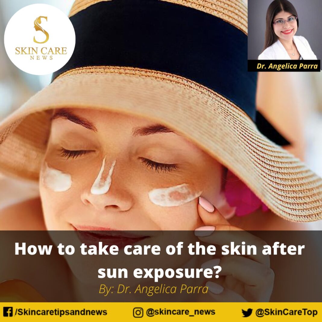 How to take care of the skin after sun exposure? Skincare News