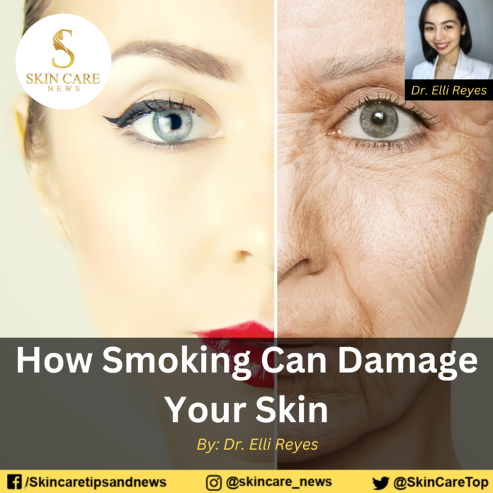 Smoking Can Damage Your Skin