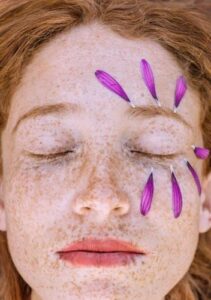 How to Get Rid of Stubborn Blackheads?