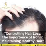 “Controlling Hair Loss: The Importance of Iron in Maintaining Healthy Hair” "Controlling Hair Loss: The Importance of Iron in Maintaining Healthy Hair"