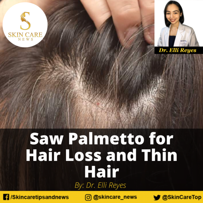 Saw Palmetto for Hair Loss and Thin Hair