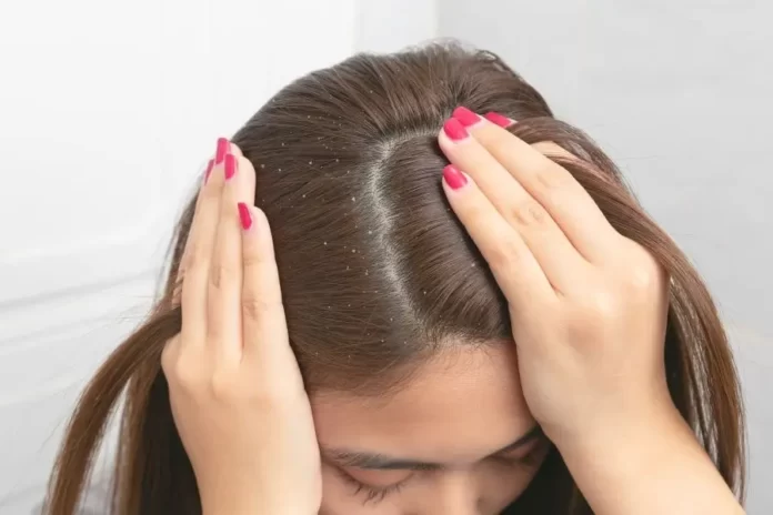 Understanding Your Scalp Type: A Guide to Healthy Hair