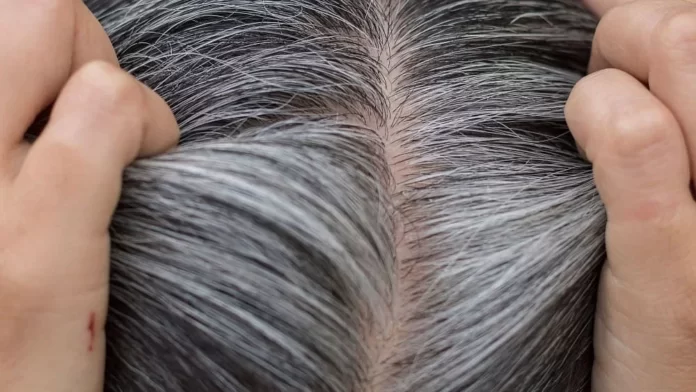 Premature Greying: Exploring the Causes of Young Age Grey Hair