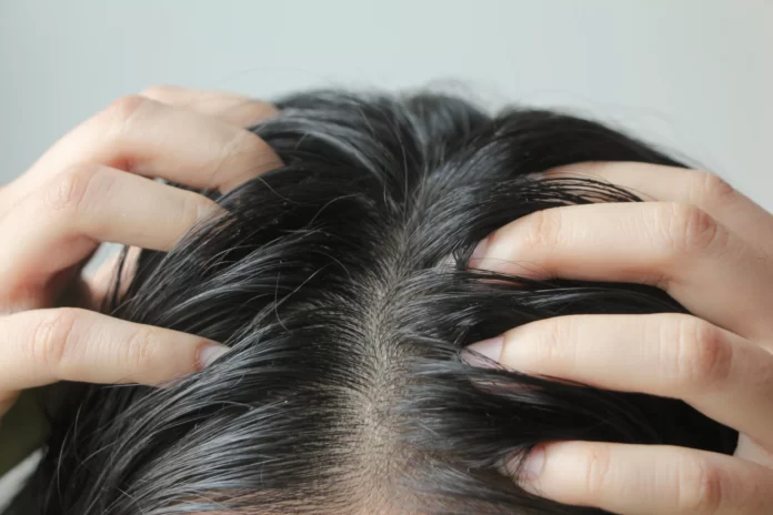 Tips for Managing an Oily Scalp and Achieving Balanced Hair