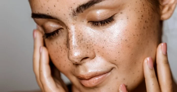 Dealing with Dry Skin: Tips for a Healthy and Hydrated Complexion
