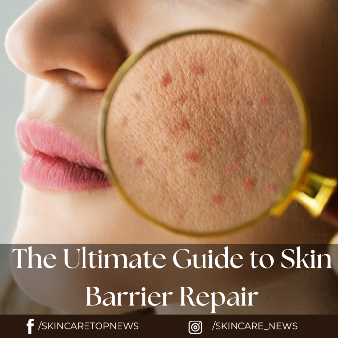The Ultimate Guide to Skin Barrier Repair
