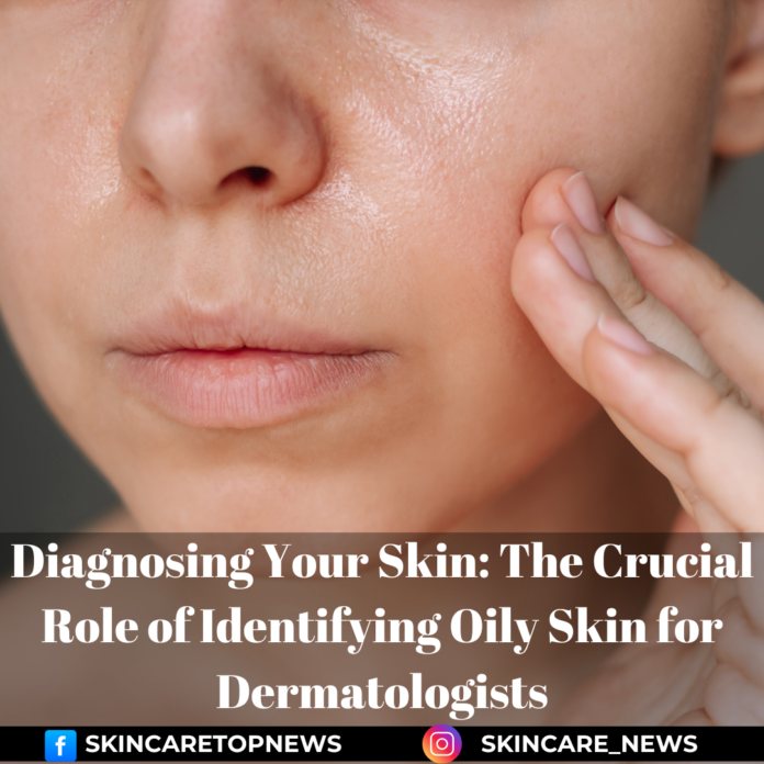 Diagnosing Your Skin: The Crucial Role of Identifying Oily Skin for Dermatologists